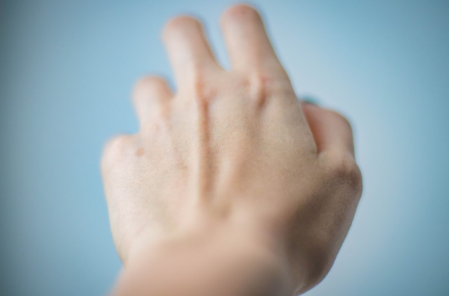 醋泡手的功效與作用 醋泡手有什么好處和壞處 醋泡手的功效與作用 醋泡手有什么好處和壞處