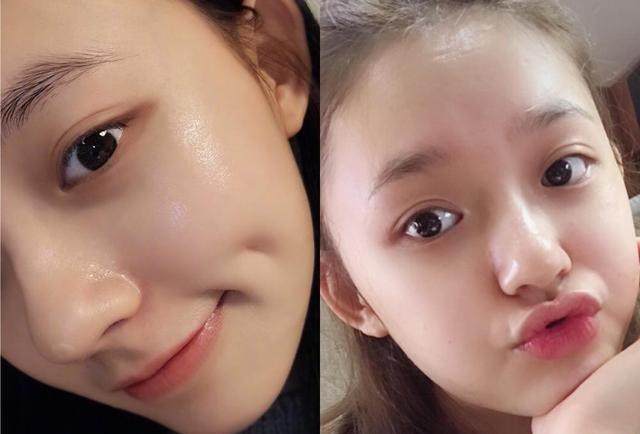 打水光針幾天能恢復(fù)好呢 打水光針的好處和壞處 打水光針幾天能恢復(fù)好呢 打水光針的好處和壞處