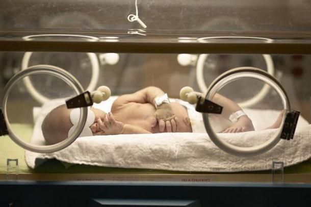 新生兒黃疸吃什么藥 新生兒黃疸的檢測方法 新生兒黃疸吃什么藥 新生兒黃疸的檢測方法