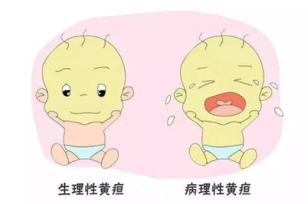 新生兒黃疸是什么原因引起的 新生兒黃疸多久能退完 新生兒黃疸是什么原因引起的 新生兒黃疸多久能退完