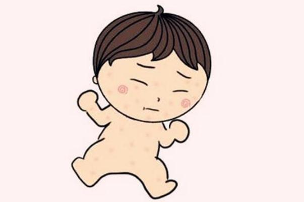 嬰兒濕疹是熱出來的嗎 嬰兒濕疹是什么樣子的 嬰兒濕疹是熱出來的嗎 嬰兒濕疹是什么樣子的