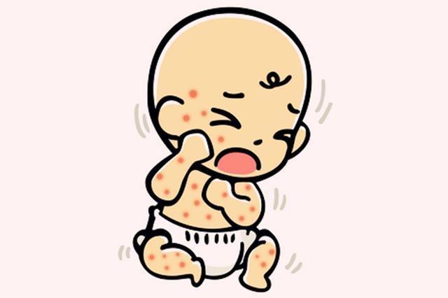 嬰兒濕疹是什么原因引起的起的 嬰兒濕疹怎么護理好得快 嬰兒濕疹是什么原因引起的起的 嬰兒濕疹怎么護理好得快