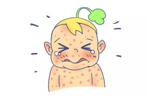 寶寶一般什么時(shí)候長水痘 寶寶長水痘的癥狀 寶寶一般什么時(shí)候長水痘 寶寶長水痘的癥狀