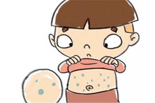 寶寶一般什么時(shí)候長水痘 寶寶長水痘的癥狀 寶寶一般什么時(shí)候長水痘 寶寶長水痘的癥狀