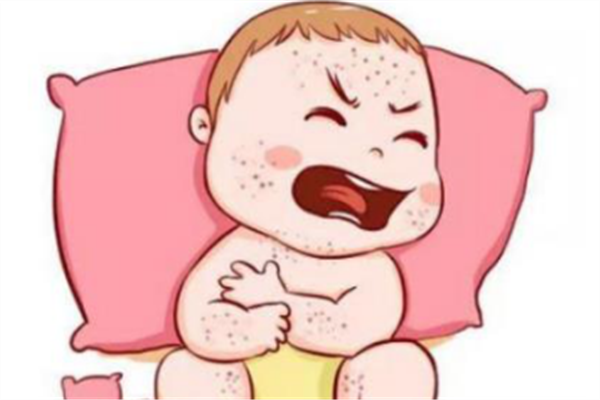 寶寶耳朵濕疹怎么辦 寶寶濕疹什么原因造成的 寶寶耳朵濕疹怎么辦 寶寶濕疹什么原因造成的