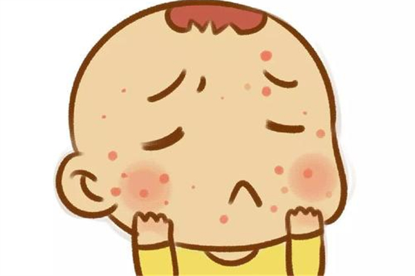 寶寶耳朵濕疹怎么辦 寶寶濕疹什么原因造成的 寶寶耳朵濕疹怎么辦 寶寶濕疹什么原因造成的