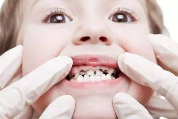 兒童換牙齒可以吃雞蛋嗎 兒童換牙齒可以拔嗎 兒童換牙齒可以吃雞蛋嗎 兒童換牙齒可以拔嗎