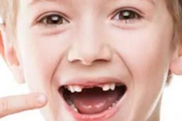 兒童換牙齒的順序和時(shí)間 兒童換牙齒要多久時(shí)間才能長(zhǎng)出來(lái) 兒童換牙齒的順序和時(shí)間 兒童換牙齒要多久時(shí)間才能長(zhǎng)出來(lái)