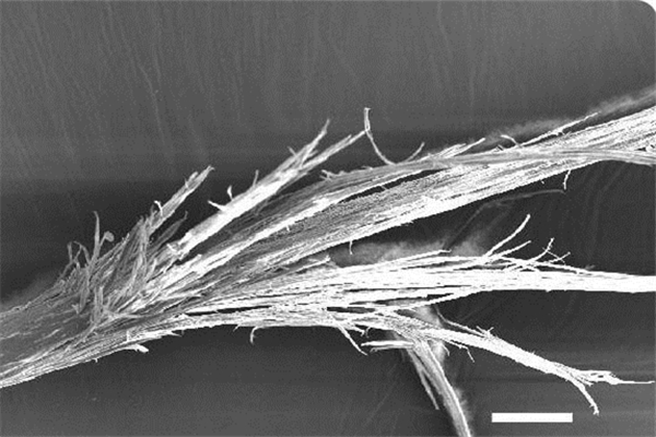 頭發(fā)有分叉怎么辦 頭發(fā)有分叉怎么護理 頭發(fā)有分叉怎么辦 頭發(fā)有分叉怎么護理