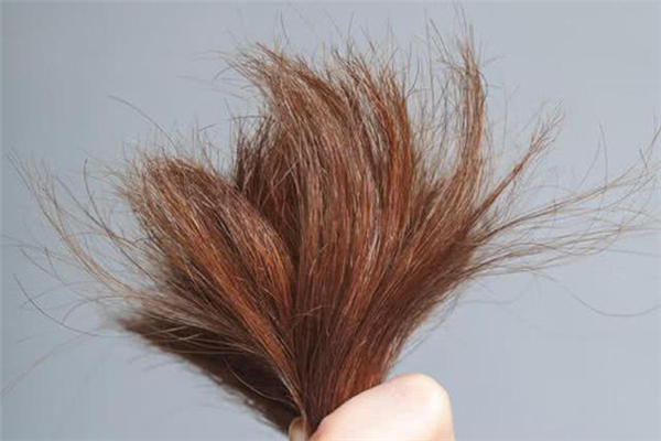 頭發(fā)有分叉怎么辦 頭發(fā)有分叉怎么護(hù)理 頭發(fā)有分叉怎么辦 頭發(fā)有分叉怎么護(hù)理