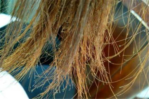 頭發(fā)有分叉怎么辦 頭發(fā)有分叉怎么護(hù)理 頭發(fā)有分叉怎么辦 頭發(fā)有分叉怎么護(hù)理