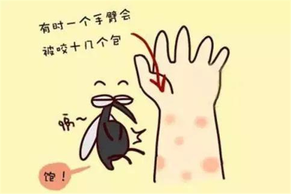 蚊子咬了怎么消腫止癢最快 蚊子咬了擦什么藥膏 蚊子咬了怎么消腫止癢最快 蚊子咬了擦什么藥膏