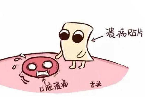 口腔潰瘍?cè)趺粗魏玫淖羁?口腔潰瘍是什么原因造成 口腔潰瘍?cè)趺粗魏玫淖羁?口腔潰瘍是什么原因造成