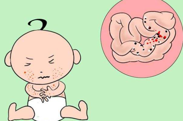 孩子過敏為什么眼睛腫 寶寶過敏眼睛腫了怎么消腫 孩子過敏為什么眼睛腫 寶寶過敏眼睛腫了怎么消腫