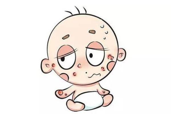 孩子過敏的癥狀有哪些 孩子過敏的原因 孩子過敏的癥狀有哪些 孩子過敏的原因