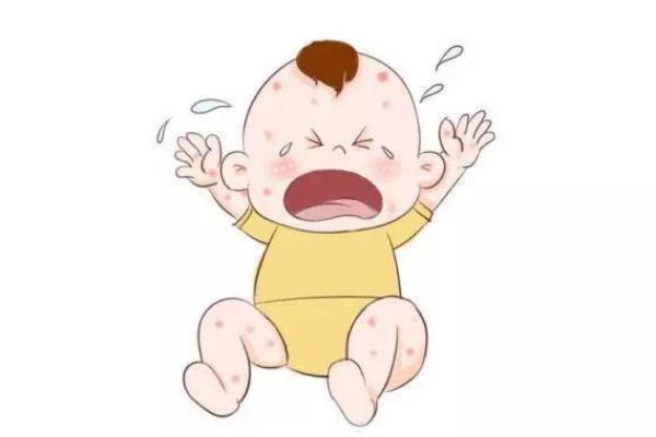 孩子身上起疙瘩很癢怎么回事 孩子過(guò)敏起疙瘩怎么辦 孩子身上起疙瘩很癢怎么回事 孩子過(guò)敏起疙瘩怎么辦