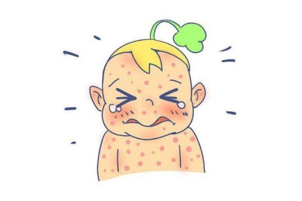 蕁麻疹會(huì)引起什么并發(fā)癥 蕁麻疹會(huì)引起高燒嗎 蕁麻疹會(huì)引起什么并發(fā)癥 蕁麻疹會(huì)引起高燒嗎