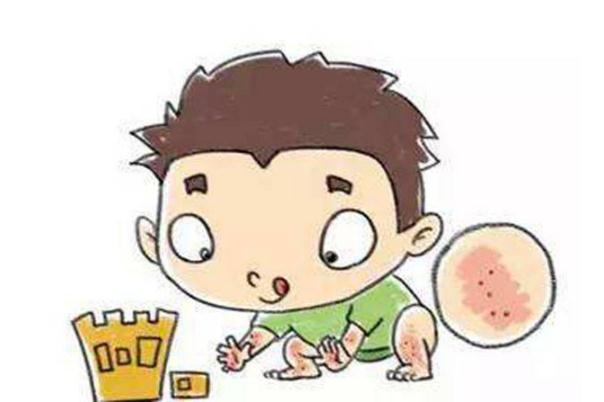 蕁麻疹可以洗熱水澡嗎 蕁麻疹可以徹底治愈嗎 蕁麻疹可以洗熱水澡嗎 蕁麻疹可以徹底治愈嗎