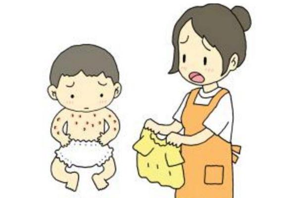 蕁麻疹是免疫力低造成的嗎 蕁麻疹有遺傳性嗎 蕁麻疹是免疫力低造成的嗎 蕁麻疹有遺傳性嗎