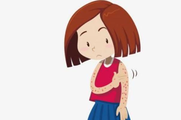 蕁麻疹對生育有影響嗎 蕁麻疹對胎兒發(fā)育有影響嗎 蕁麻疹對生育有影響嗎 蕁麻疹對胎兒發(fā)育有影響嗎