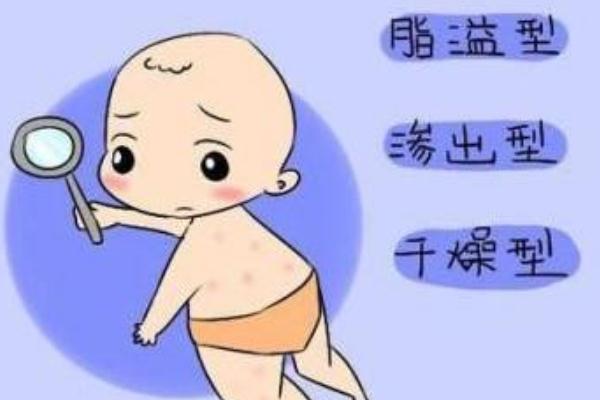 新生兒濕疹怎么治療最好的方法 新生兒濕疹是什么引起的 新生兒濕疹怎么治療最好的方法 新生兒濕疹是什么引起的