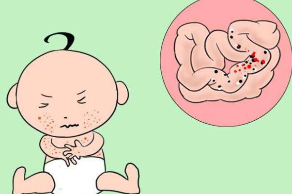 嬰兒過敏嚴(yán)重會怎么樣 嬰兒過敏嚴(yán)重有自愈可能嗎 嬰兒過敏嚴(yán)重會怎么樣 嬰兒過敏嚴(yán)重有自愈可能嗎