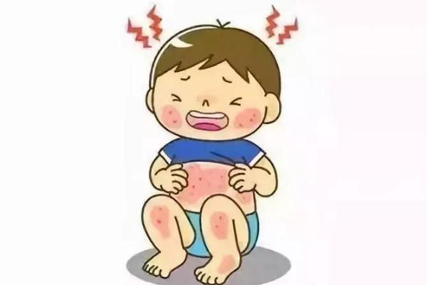 新生兒濕疹可以打預防針嗎 新生兒濕疹可以用爐甘石嗎 新生兒濕疹可以打預防針嗎 新生兒濕疹可以用爐甘石嗎