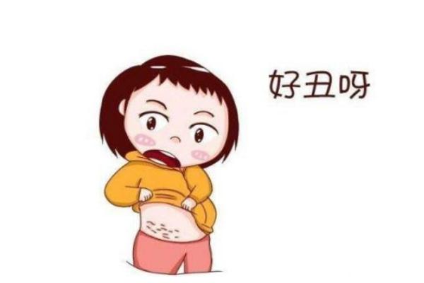 妊娠紋能修復(fù)嗎 妊娠紋能淡化嗎 妊娠紋能修復(fù)嗎 妊娠紋能淡化嗎