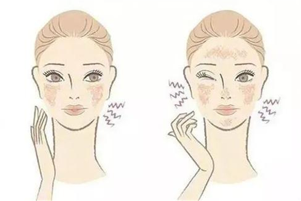 敏感肌可以涂防曬嗎 敏感肌涂防曬霜會(huì)過(guò)敏嗎 敏感肌可以涂防曬嗎 敏感肌涂防曬霜會(huì)過(guò)敏嗎