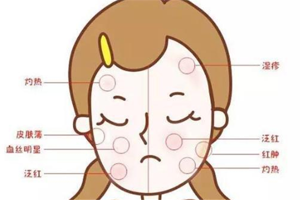 敏感肌可以用蘆薈膠嗎 敏感肌適合什么成分的護(hù)膚品 敏感肌可以用蘆薈膠嗎 敏感肌適合什么成分的護(hù)膚品