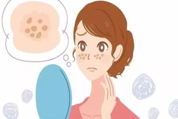 妊娠斑是怎么形成的 妊娠斑怎么調(diào)理可以淡斑 妊娠斑是怎么形成的 妊娠斑怎么調(diào)理可以淡斑