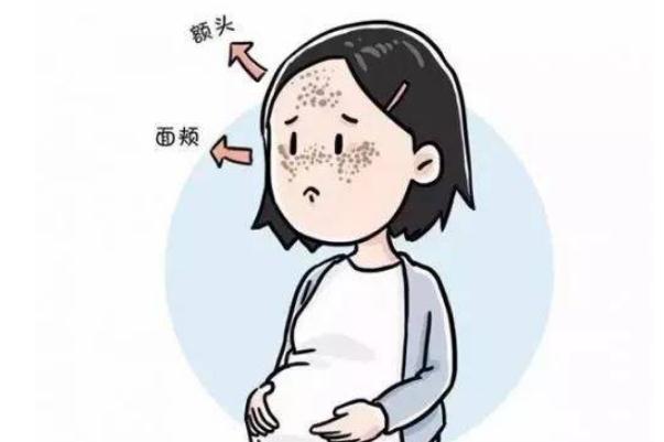 妊娠斑會(huì)自動(dòng)消除嗎 妊娠斑會(huì)遺傳嗎 妊娠斑會(huì)自動(dòng)消除嗎 妊娠斑會(huì)遺傳嗎