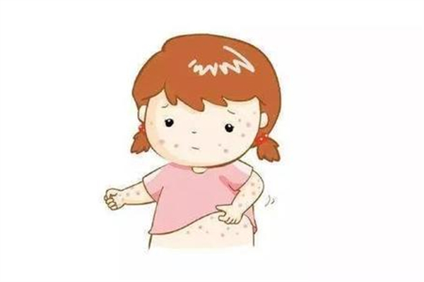 長(zhǎng)痱子怎么辦 長(zhǎng)痱子用什么藥療效比較好 長(zhǎng)痱子怎么辦 長(zhǎng)痱子用什么藥療效比較好