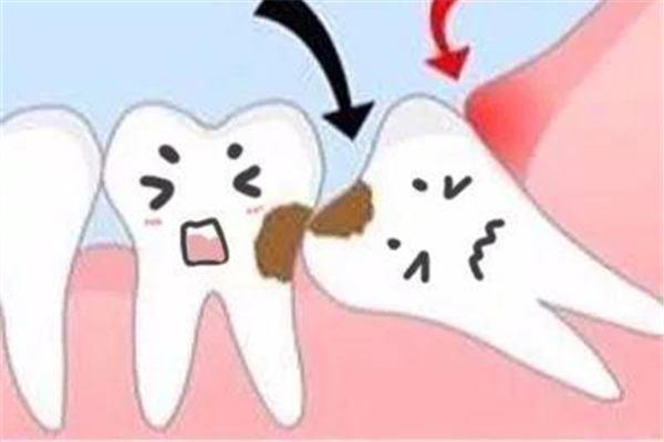 智齒什么時(shí)候拔合適 智齒一次拔幾顆合適 智齒什么時(shí)候拔合適 智齒一次拔幾顆合適