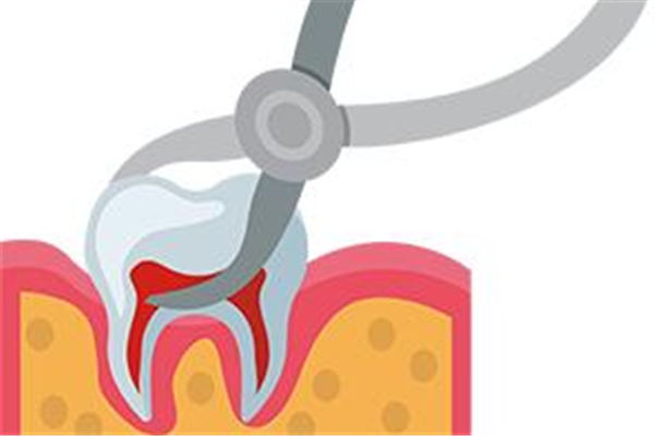 智齒拔牙后多久可以消腫 拔智齒后怎么消腫最快 智齒拔牙后多久可以消腫 拔智齒后怎么消腫最快