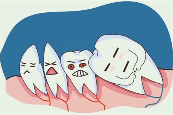 拔智齒后吃什么食物比較好 拔智齒后多久可以正常吃飯 拔智齒后吃什么食物比較好 拔智齒后多久可以正常吃飯