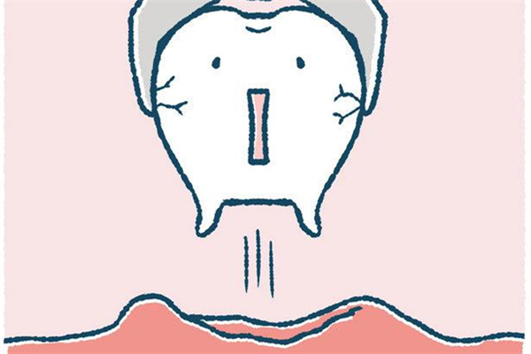 拔智齒后吃什么食物比較好 拔智齒后多久可以正常吃飯 拔智齒后吃什么食物比較好 拔智齒后多久可以正常吃飯