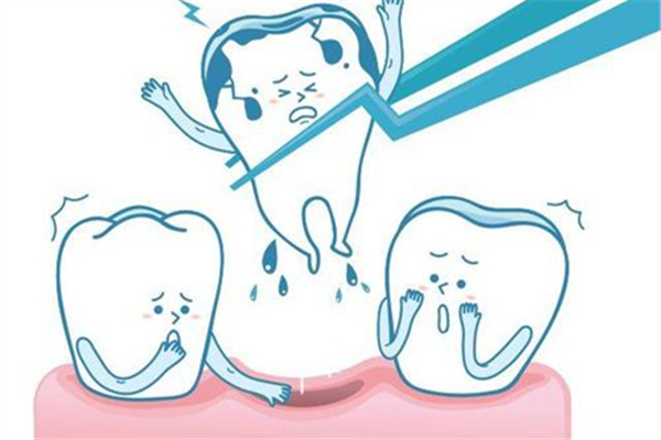智齒拔牙后多久可以消腫 拔智齒后怎么消腫最快 智齒拔牙后多久可以消腫 拔智齒后怎么消腫最快