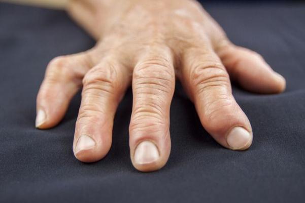 風濕病可以天天洗澡嗎 風濕病可以吃蝦嗎 風濕病可以天天洗澡嗎 風濕病可以吃蝦嗎