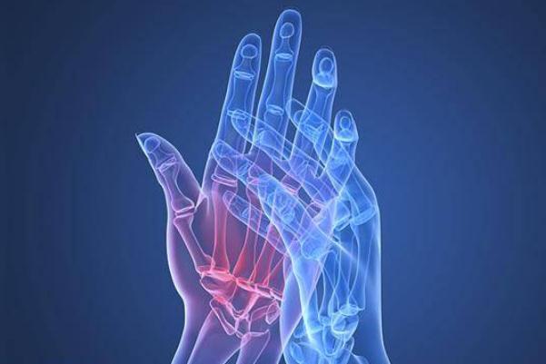 風(fēng)濕病會(huì)傳染他人嗎 風(fēng)濕病會(huì)發(fā)燒嗎 風(fēng)濕病會(huì)傳染他人嗎 風(fēng)濕病會(huì)發(fā)燒嗎