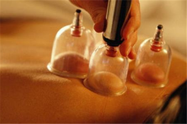 拔罐什么季節(jié)拔最好 拔罐多久一次合適 拔罐什么季節(jié)拔最好 拔罐多久一次合適