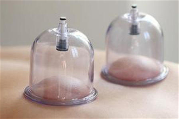 拔罐什么季節(jié)拔最好 拔罐多久一次合適 拔罐什么季節(jié)拔最好 拔罐多久一次合適