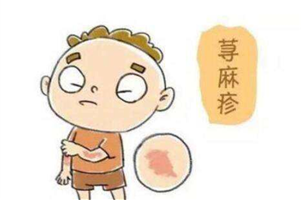 濕氣重會引起蕁麻疹嗎 濕氣重會引起皮膚病嗎 濕氣重會引起蕁麻疹嗎 濕氣重會引起皮膚病嗎