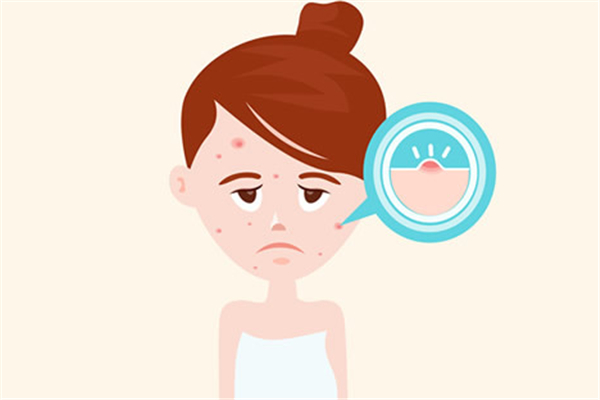 痘痘肌適合用什么洗面奶 痘痘肌膚怎么調(diào)理小常識 痘痘肌適合用什么洗面奶 痘痘肌膚怎么調(diào)理小常識