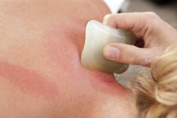 刮痧對頸椎病有好處嗎 刮痧對腎虛有好處嗎 刮痧對頸椎病有好處嗎 刮痧對腎虛有好處嗎