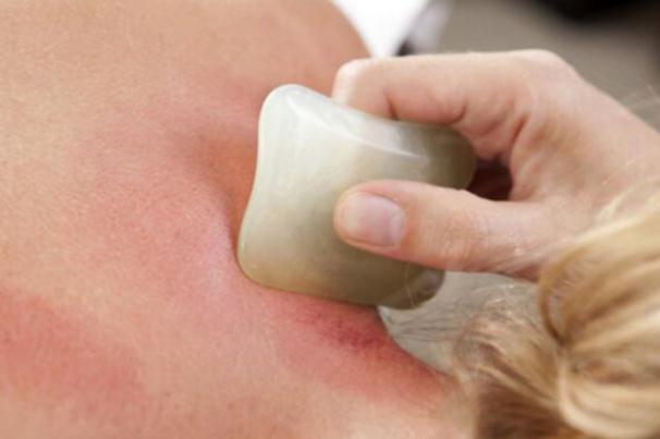 刮痧的作用與功效 刮痧的好處與壞處 刮痧的作用與功效 刮痧的好處與壞處