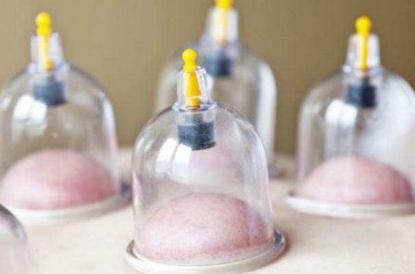 拔火罐會(huì)出血嗎 拔火罐會(huì)拔出水嗎 拔火罐會(huì)出血嗎 拔火罐會(huì)拔出水嗎