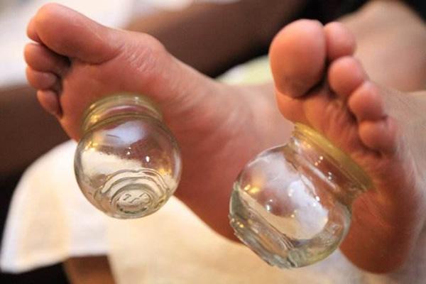 拔火罐能去濕氣嗎 拔火罐起水泡是怎么回事 拔火罐能去濕氣嗎 拔火罐起水泡是怎么回事