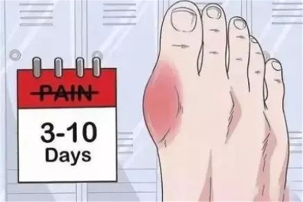 尿酸高對(duì)腎功能有影響嗎 尿酸高對(duì)腎功能有哪些影響 尿酸高對(duì)腎功能有影響嗎 尿酸高對(duì)腎功能有哪些影響