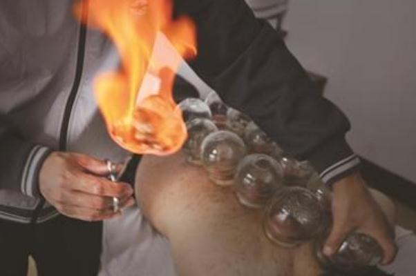 拔火罐的印子多久消除 拔火罐的頻率多久一次 拔火罐的印子多久消除 拔火罐的頻率多久一次